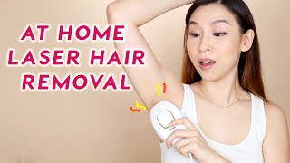 At-Home Laser Hair Removal - Does It Work?  | Tina Tries It