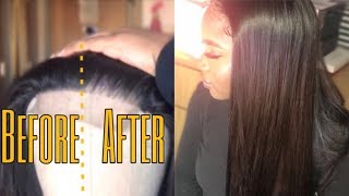 Make A Closure Look Like A Frontal Ft. Alipearl Hair (Plucking & Styling)