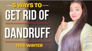 Dandruff Treatment At Home : Dandruff को जड़ से खत्म करें और बालों का झड़ना रोके सिर्फ 1 हफ्ते में