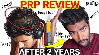 Is Hair Loss Treatment(Prp) Worth It Or Not?