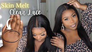 *New* Clear Invisible Lace Wig | Undetectable Natural Hairline No Plucking Needed!! | Xrsbeautyhair