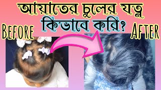 Bacchader Chul | বাচ্চাদের চুলের যত্ন | Bacchader Chul Boro Hobe Druto| Baby Hair Care Tips Bangla |