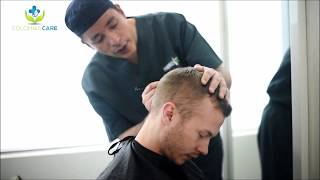 2000 Grafts Hair Transplant With Robot Artas At Colombia Care With Dr. Maldonado In Medellin