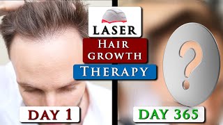Laser Hair Growth Therapy Review || Irestore Device Before & After