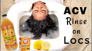My First Acv Rinse For Locs | Naturally Michy