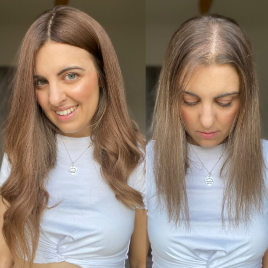 How losing half my hair ended up changing my life for the better