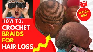 Crochet Braids For Hair Loss |Kima Ocean Wave | Alopecia Awareness