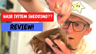 Excessive Hair Shedding | Hair System Review