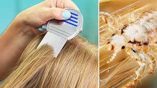 Lice In Our House? | Tips For Natural Lice Removal & Treatment