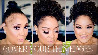 How To Cover Your Bald Thin Edges! (Traction Alopecia)