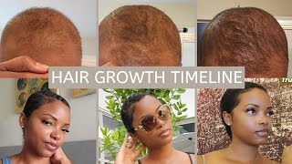 From Bald To Pixie: Hair Growth Timeline!