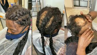 Over 20Yrs Of Marriage & Her Husband Has Never Seen Her Real Hair, Epic Alopecia Hair Transformation