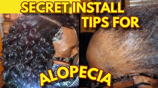 Alopecia Weave Method! Secret Tips & Techniques For Short & Thin Hairstyles