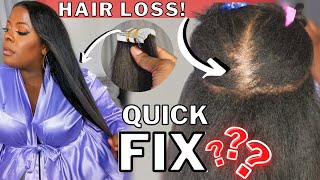 Yikes! I'M Losing My Hair!  || Textured Tape In Extensions On Fine Hair With Hair Loss|| Ft Ywi