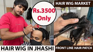 Front Line Australian Hair Patch, Hair Wig Market Jhansi (झाँसी) City In Uttar Pradesh