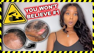 How Not To Remove Your Lace Wig