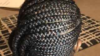 How To Relieve Pain From Tight Sew-Ins And Braids Live | Lemonade Braids
