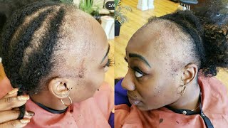 You Will Not Believe How Gorgeous She Looks After This Transformation, Extreme Alopecia Hair Makeove