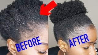 How To Get Rid Of Gel Flaking On Natural Hair!!!| Mona B.