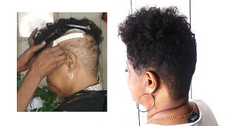 I Made Her A Lace Hair Unit To Conceal Her Alopecia And Then Installed It In 3 Easy Steps.