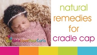 ♥ 52 ♥ Baby Hair Care - Natural Remedies For Cradle Cap