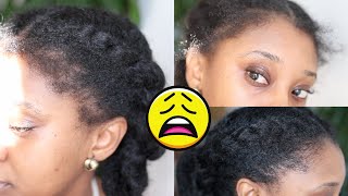 My Edges Broke Off! Let'S Try The Ordinary Hair Serum |  Natural Hair