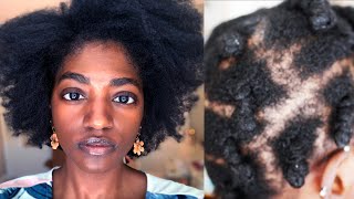 Fine. Natural. Hair. | The Realities Of Fine 4C Natural Hair