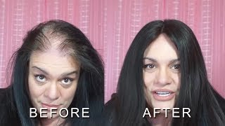 How To Hide Bald Scalp In Partial Alopecia In 2 Minutes|June Penny