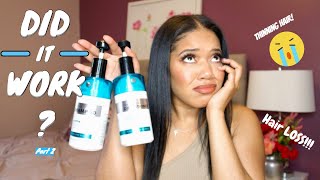 Hair Loss | How I Got My Hair To Grow | Bellisso Shampoo & Conditioner