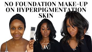Hyperpigmentation And No Foundation Make-Up On Dark Skin| Into Wigs