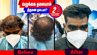 Hair Replacement | Hair Fixing | Hair Wig | Nagercoil | Salem | Coimbatore | Tamilnadu : 8110072863