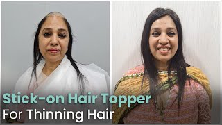 Hair Toppers For Thinning Hair | Stick On Human Hair Toppers | Hair Extensions Mumbai