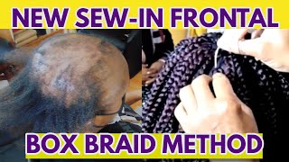 New Box Braid Sew-In Method With Frontal Braids For Alopecia, Short, Thin, Damaged, Hair