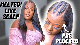 The Fake Scalp That Sold Me! || New Affordable Single Knot Layered Edge Wig || Ft Xrs Beauty