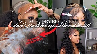 Hd Lace + Pre-Plucked Is Not Enough For High Quality Wig! The Truth Of A 13X6 Frontal Ft Keswigs