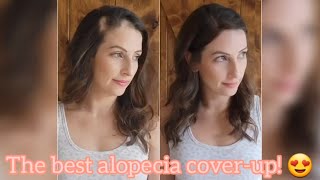 The Best Cover-Up For Alopecia Areata! @Uniwigs Hair Patches