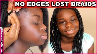 Don'T Lose Your Edges Box Braids Hairstyles | Discovering Natural