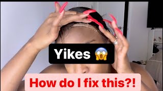 How To Fix Lifting Lace Frontal & Baby Hairs