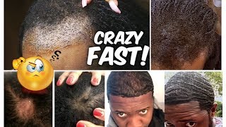 Best Oil For Faster Hair Growth!  Your Hair Will Grow Like Crazy!!!