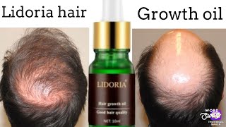 Lidoria Ginger Oil Grow Hair Super Fast Ginger Shampoo Ginger Essence ( In English )