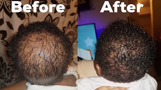 How To Grow Your Baby Bald Hair Fast Using This Natural Remedies