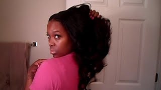 Upart Wigs And Traction Alopecia