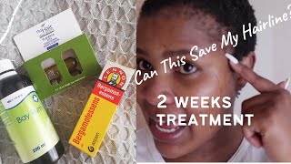 Does Bergamont Essence Really Work For Hair Growth? | My Hairline Is Receding | Hair Home Remedies