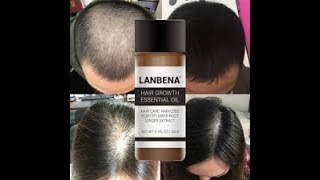 Lenbena Hair Essence (Bangla Review For Hair Fall And Hair Regrowth )