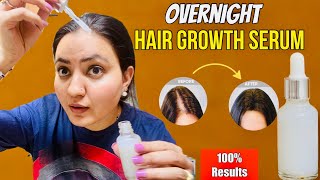 Diy Overnight Hair Re-Growth Serum : Gnjepn, Receding Hairline, Bald Patches Hlke Baalon Ko Kren Ghn
