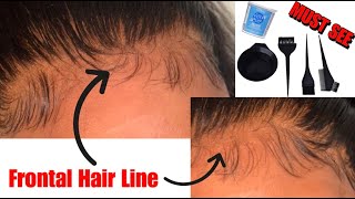 How To: Bleach Knots On Closure And Frontal | Demonstration |
