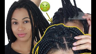 How To Clean Box Braids | Remove All Dandruff & Build-Up
