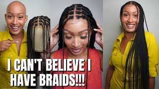 Natural Braided Wigs!! Honest Alopecia Review & Install Ft Instant Arewa Hair