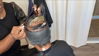 Her Crown Is Thin So We Protected It And Covered Her Crown Up| Alopecia Hair Style| Thinning Hair