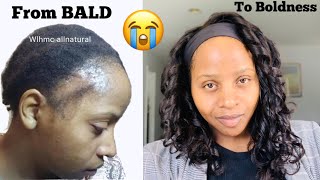 From Bald To Boldness In Just Minutes!My Favourite Natural Hair Style On Natural Hair Hairspells
